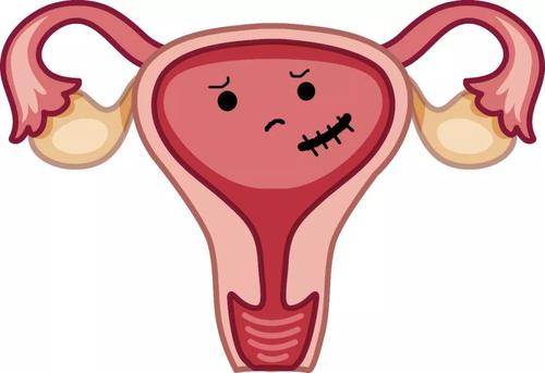 兴义妇女打胎后外阴痒可能是感染炎症